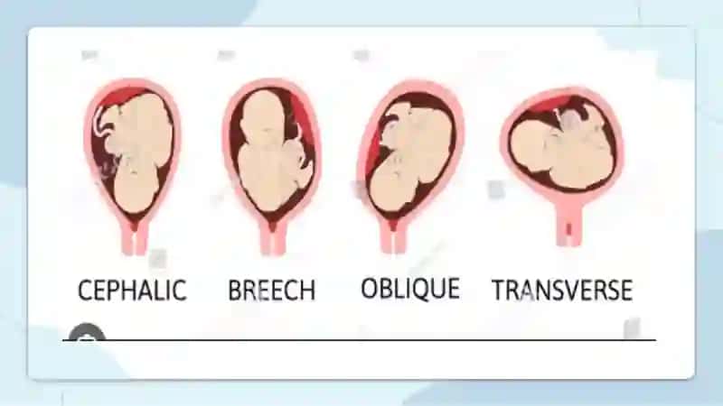 Tugʻruq biomexanizmi. Lovset va Moris-Smeyli-Veyta usullari 3