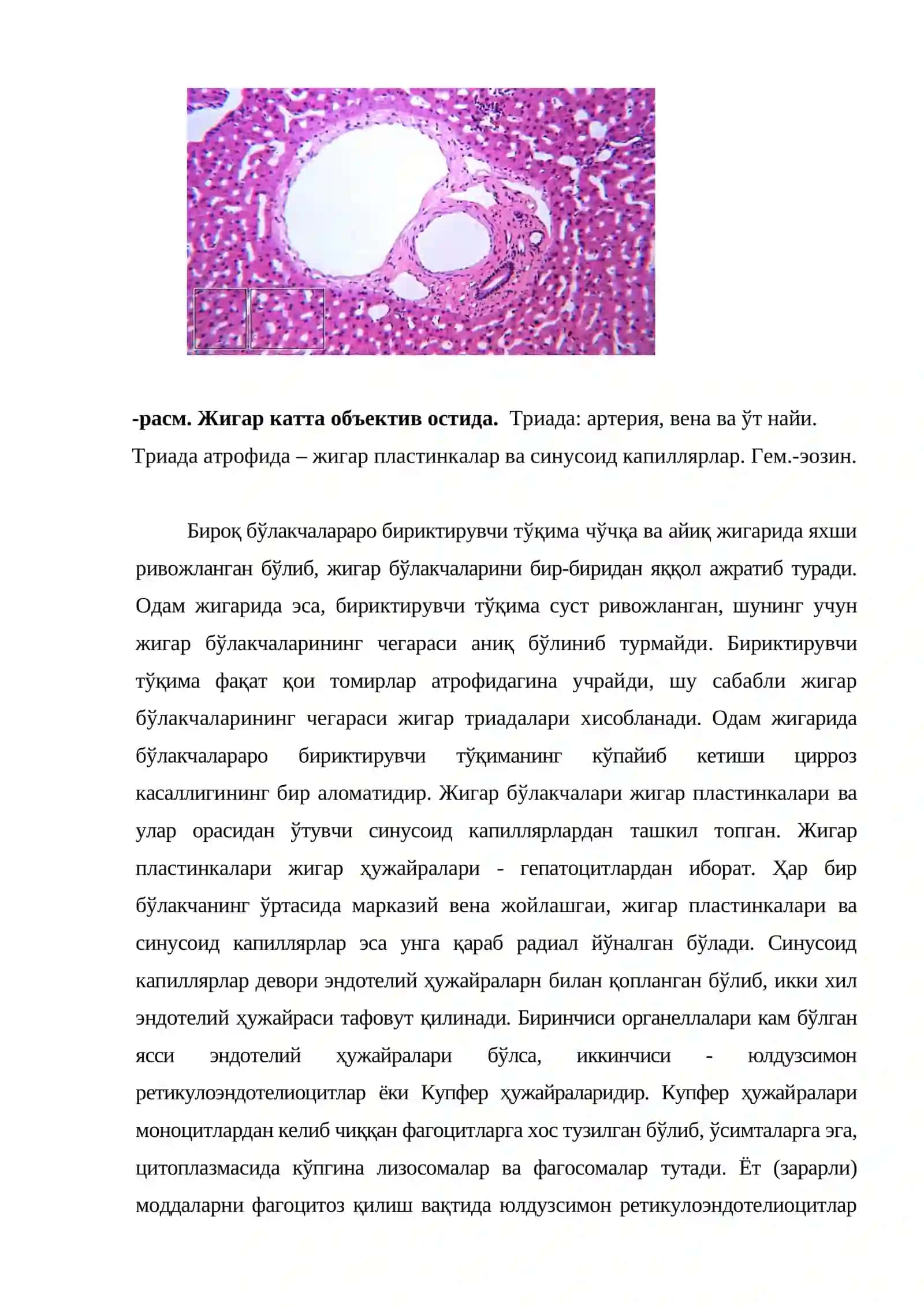 Жигар 3