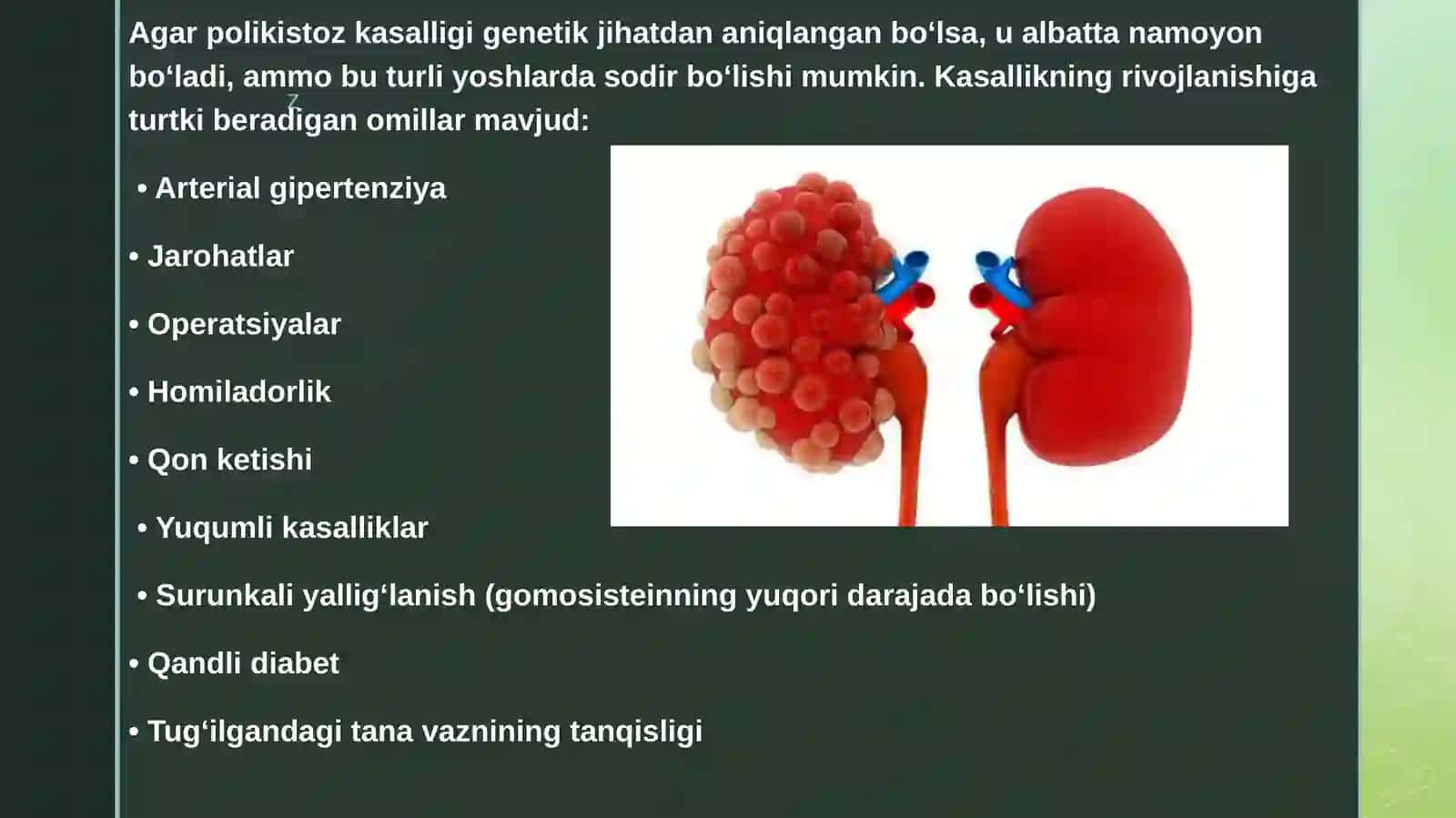 Nasliynefropatiyalar:buyrakpolikistozi,Gudpaschersindromi, Alportsindromi 3