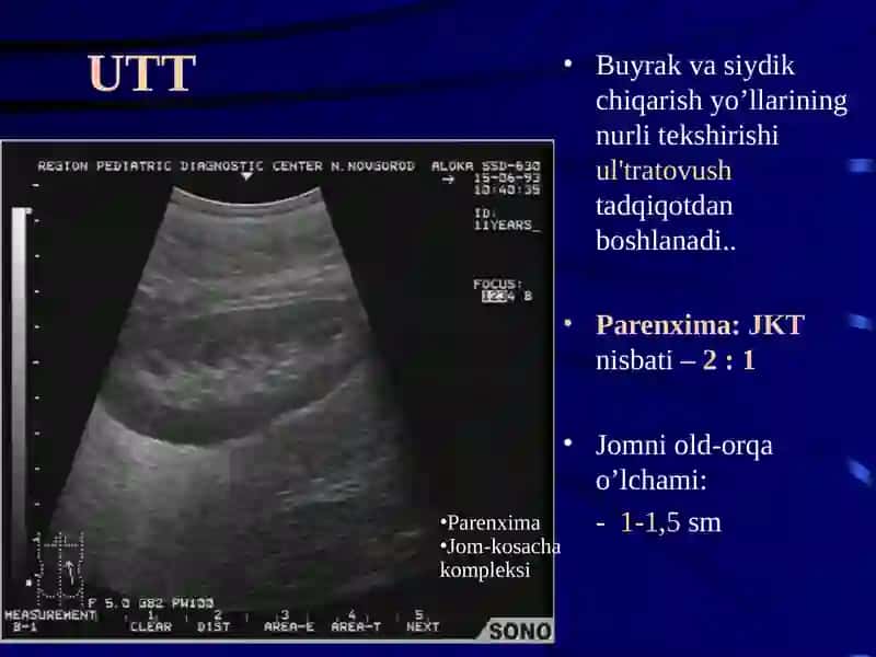 siydiq yo'llari kasalliklarining nur diagnostikasi 3