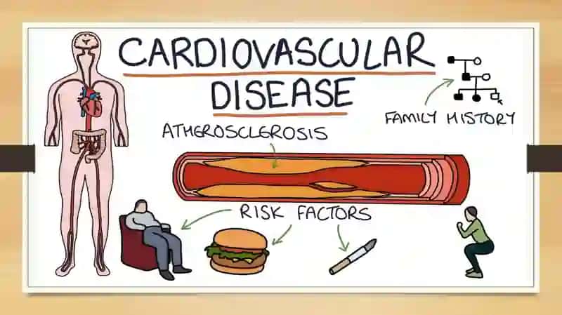 Cardiovascular disease (CVD) 3