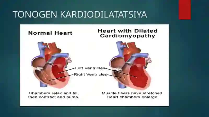TONOGEN KARDIODILATATSIYA 3
