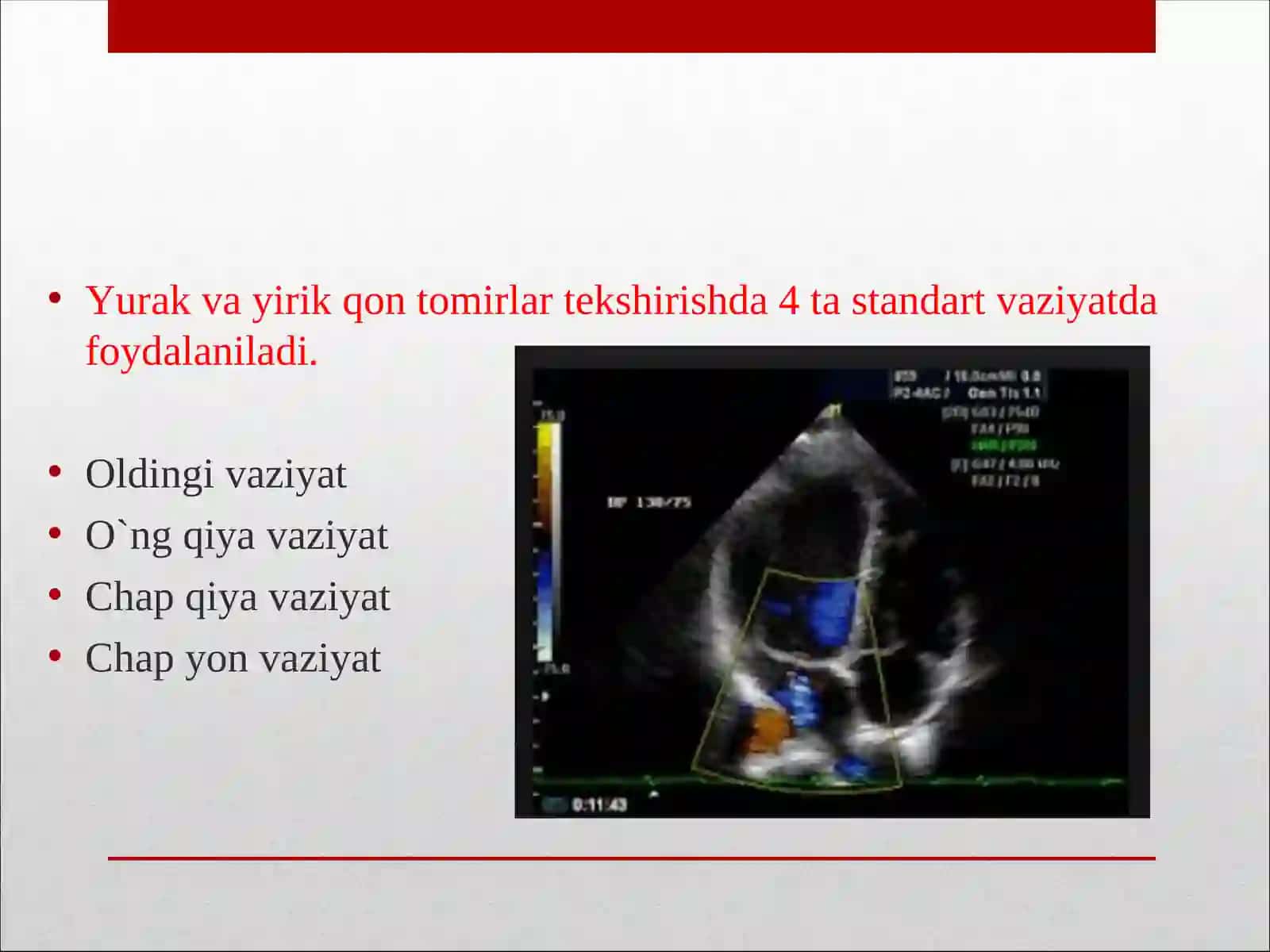 Yurak va yirik qon tomirlarni rentgenologik tekshirish usullari 3
