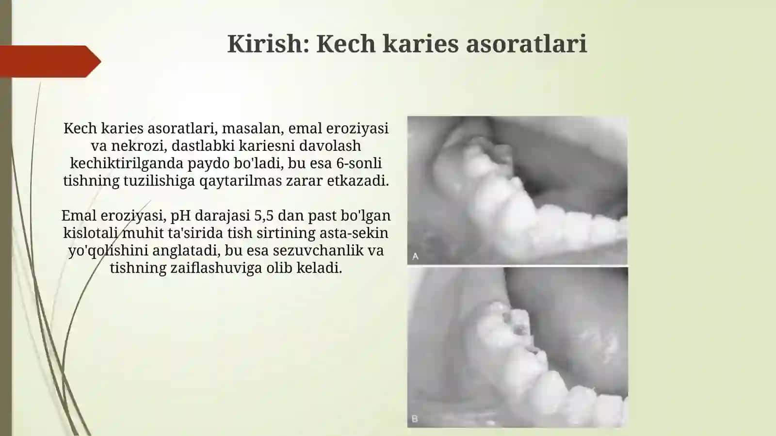 Tishchiggandankeyinpaydoboladigannokareskasailıklari.emaleroziyasivanekrozi 3