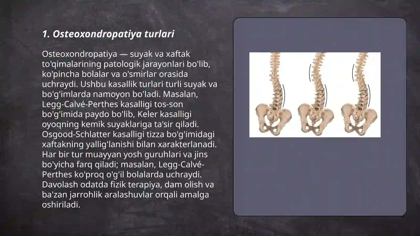 Osteoxondropatiyalar.Skalioz 3