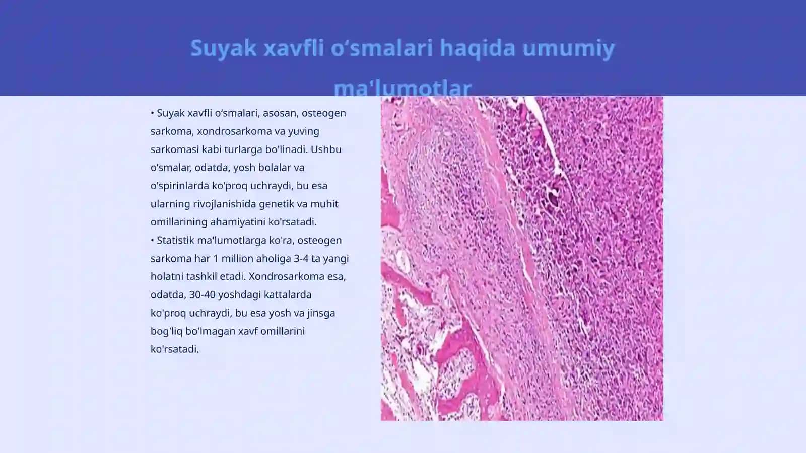 Suyak xavfli oʻsmalari 3