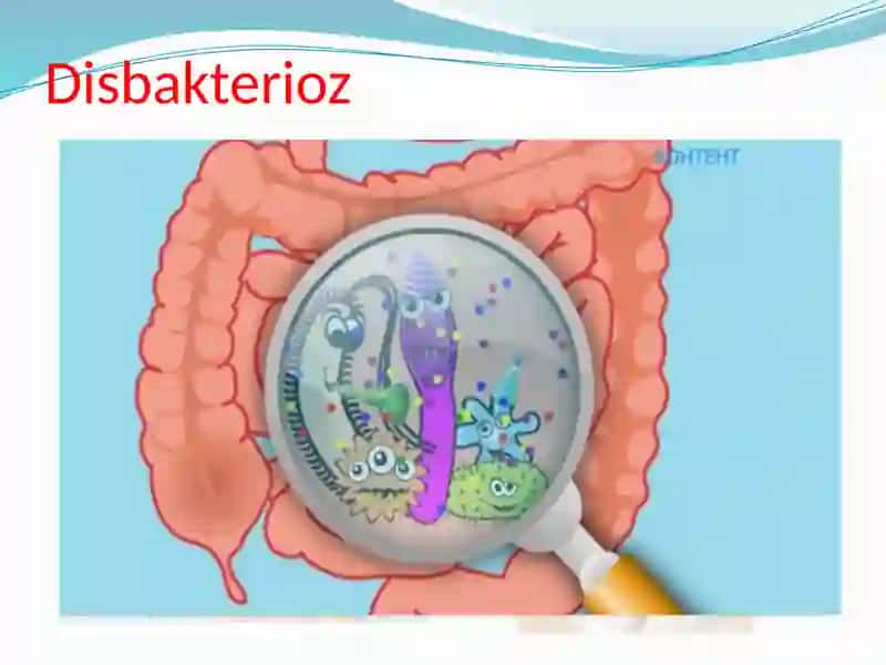 Disbakterioz 3