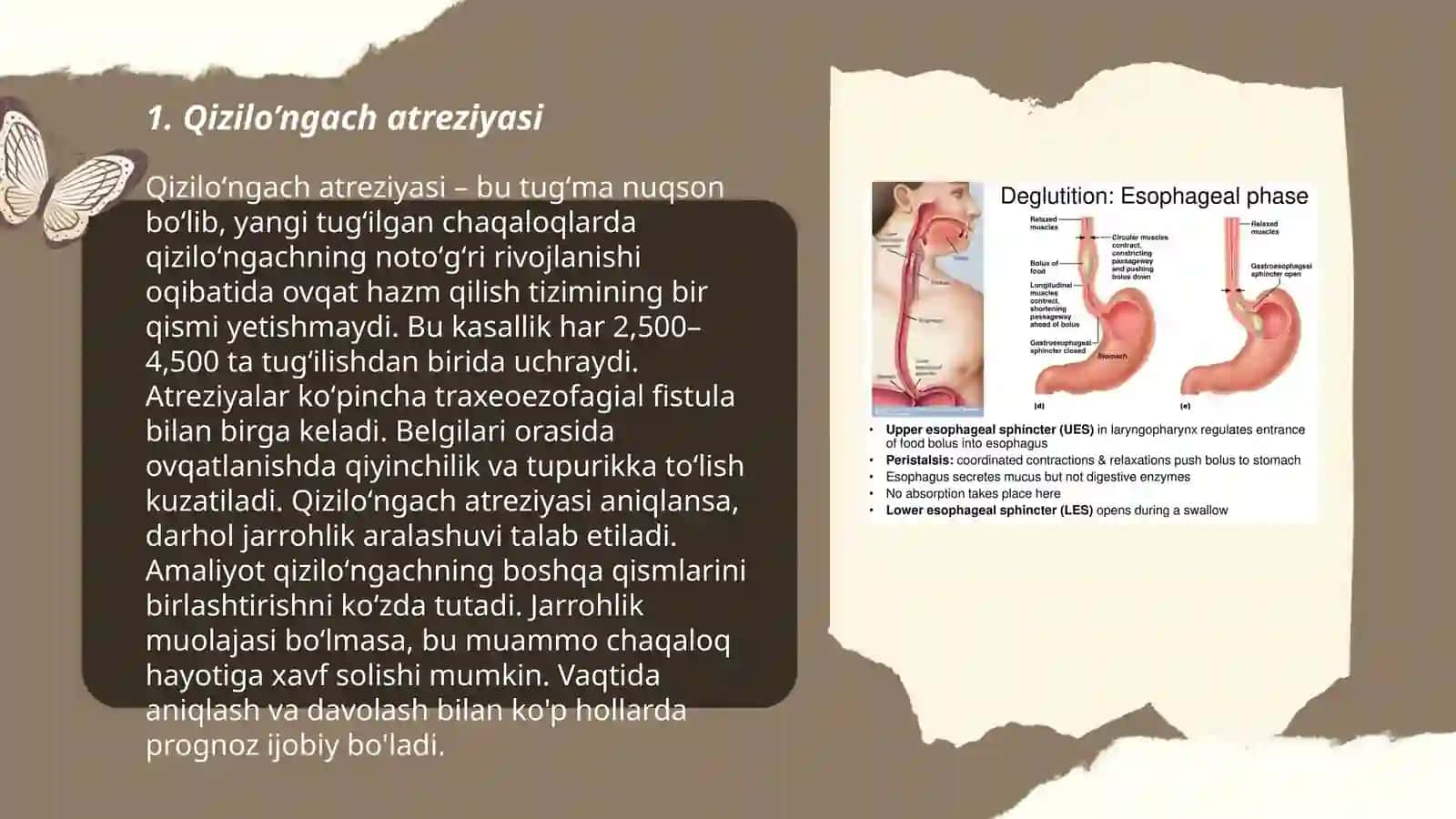 Qizilo’ngach atreziyasi 3