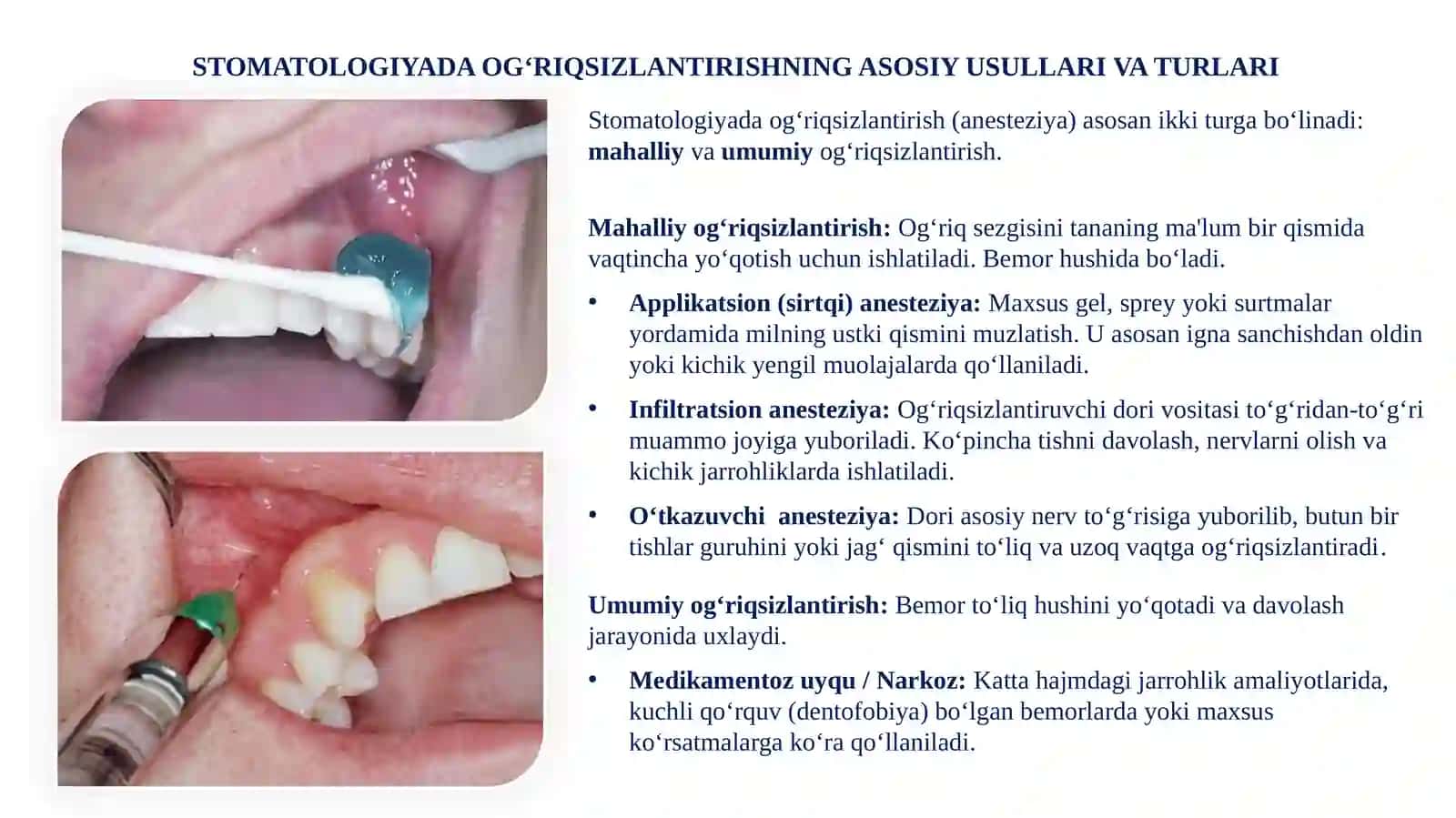 STOMATOLOGIYADA OG'RIQSIZLANTIRISH 3