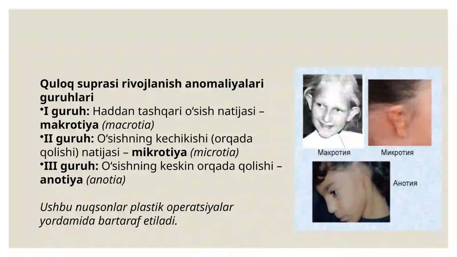 Quloqsuprasirivojlanishanomaliyalari 3