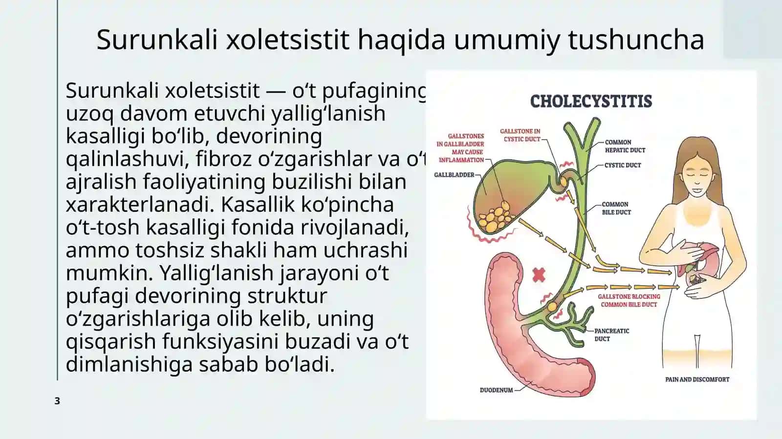 Surunkali xoletsistit va o‘t-tosh kasalligi (O‘TK) 3