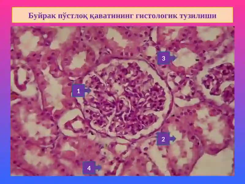 Буйрак касалликлари 3