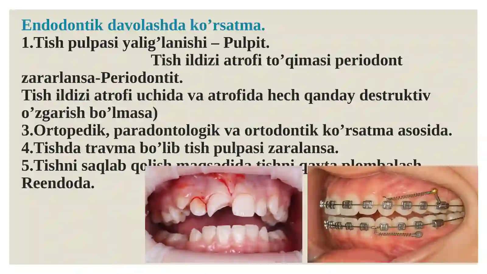 Endodontik davolash gabemorni tayyorlash 3