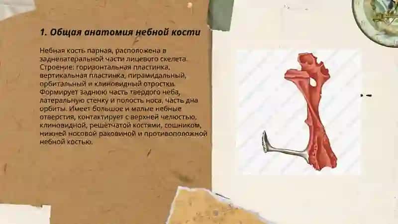 небная кость 3