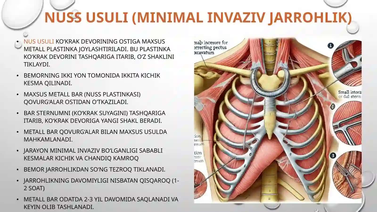 Koʻkrak devori datu gʻma va ort tirilgan nuqsonlardagi operatsiyalar 3