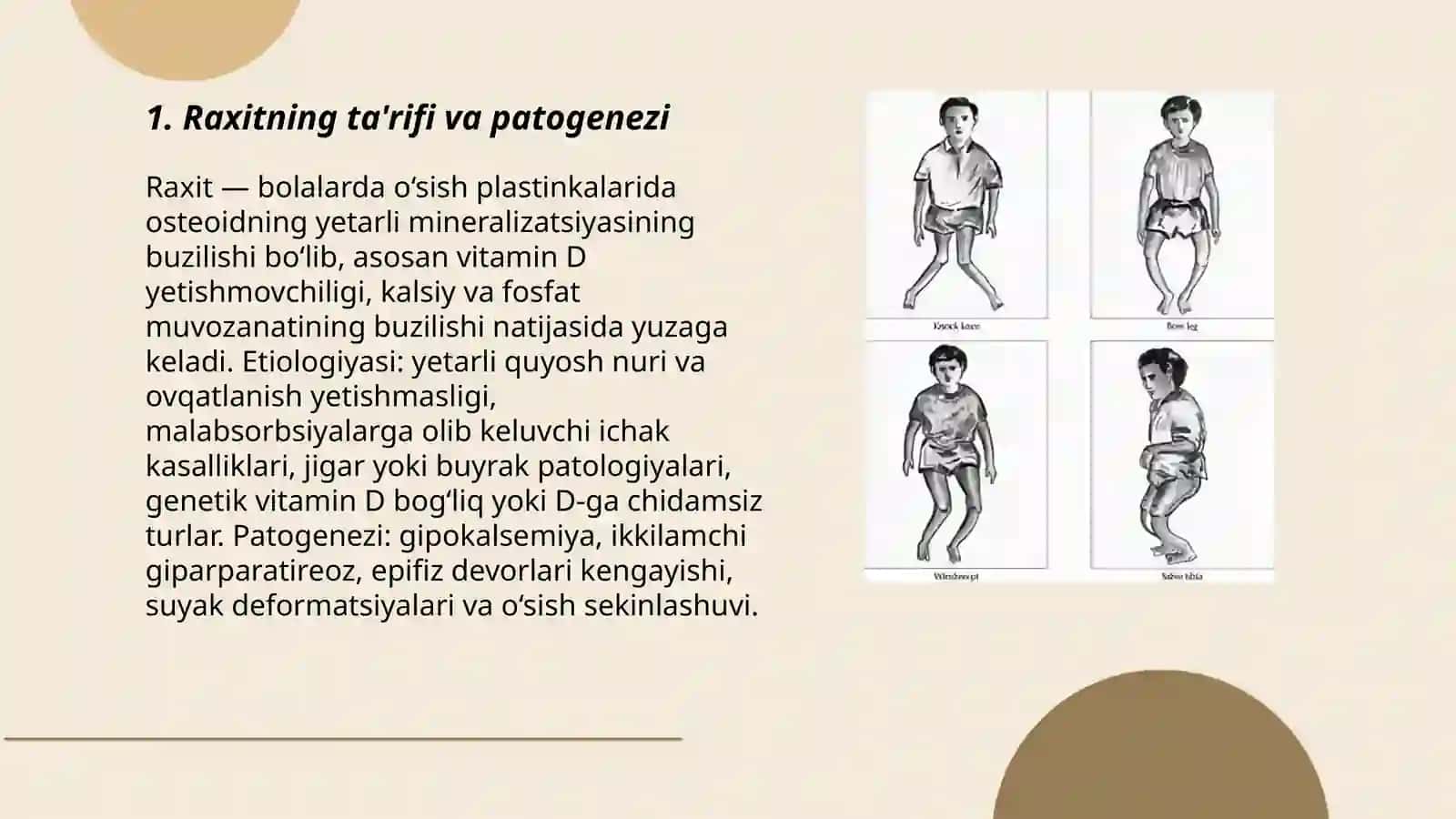 Rickets 3