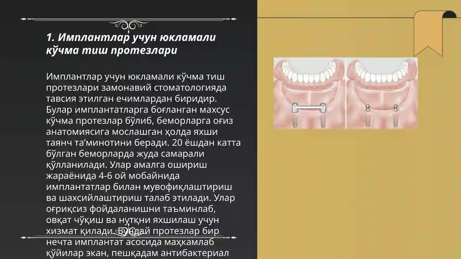 Имплантлар учун юкламали кўчма тиш протезлари 3