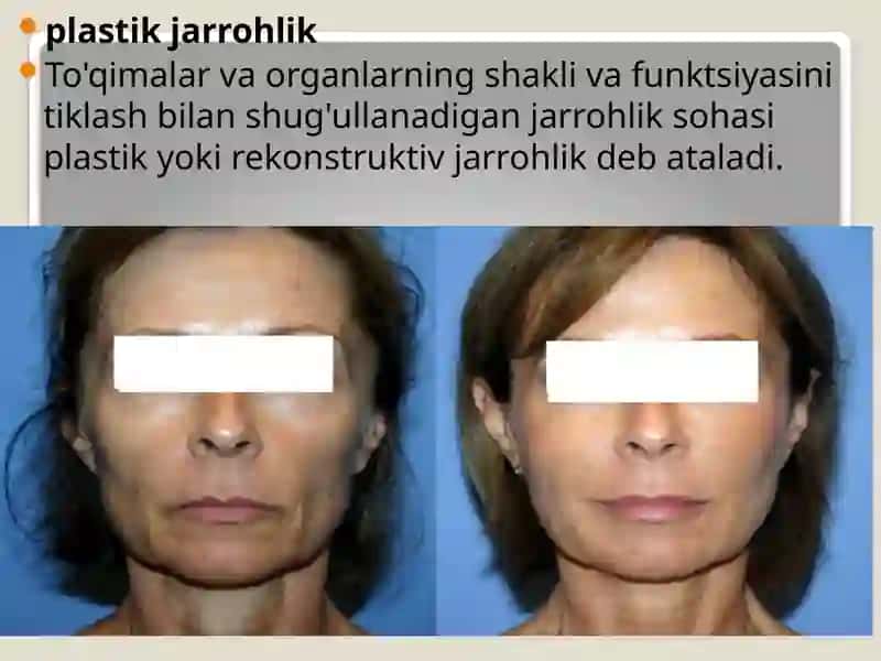 Plastik va estetik xirurgiya. 3