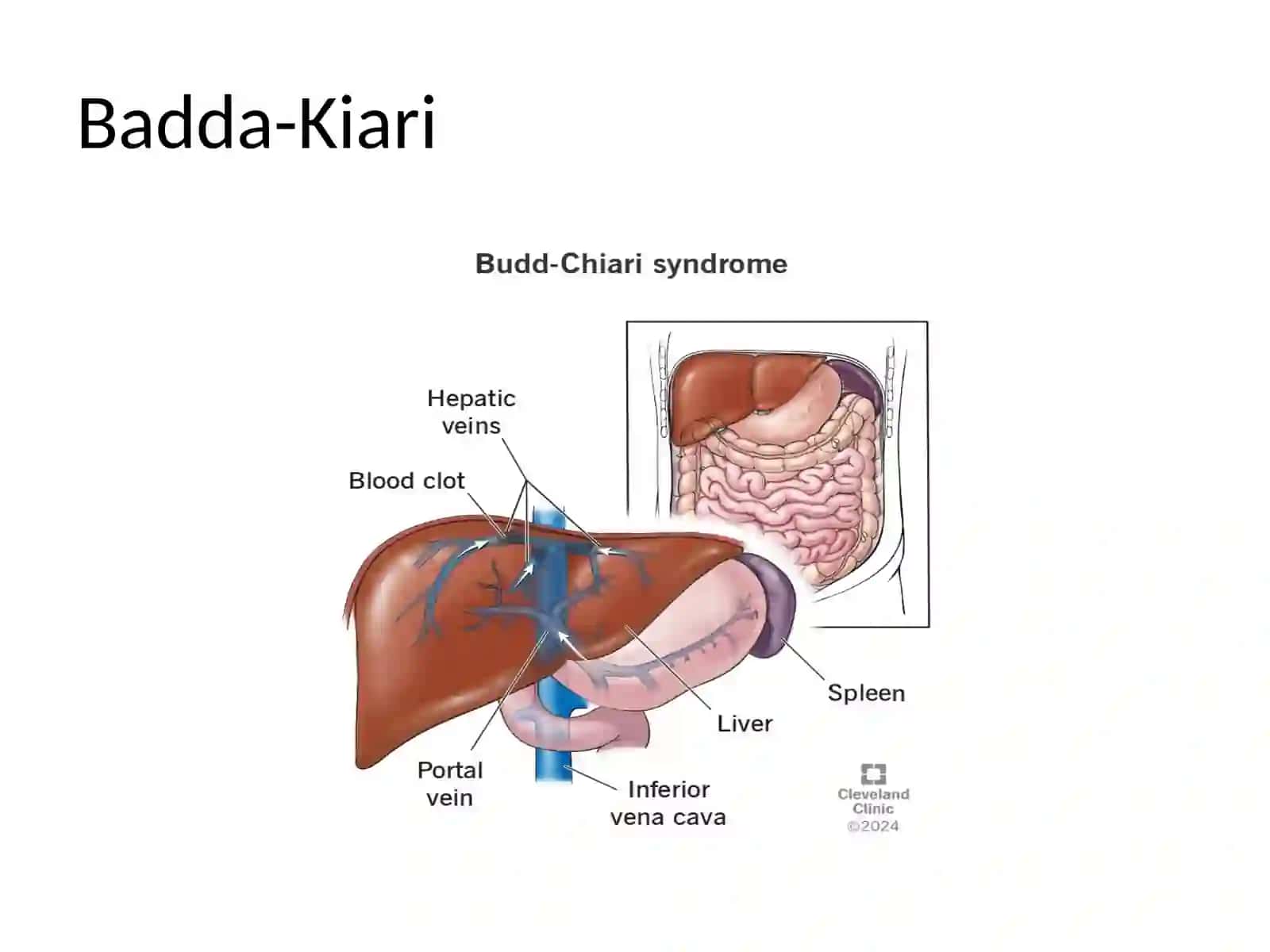 Badda kiari va Vilson kanavalov 3