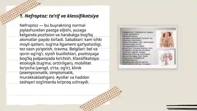 Nefroptoz 3