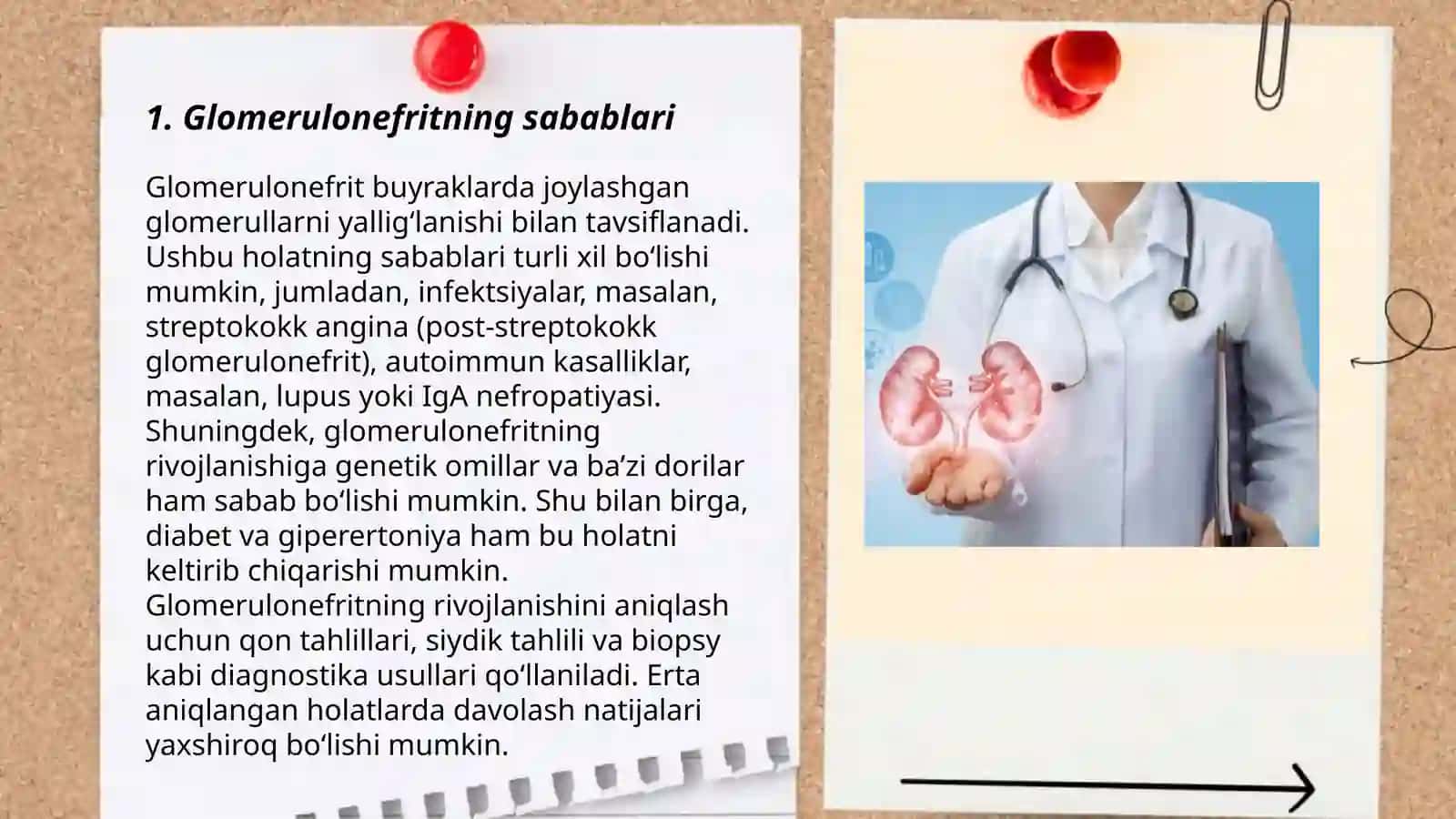 Glomerulonefrit 3