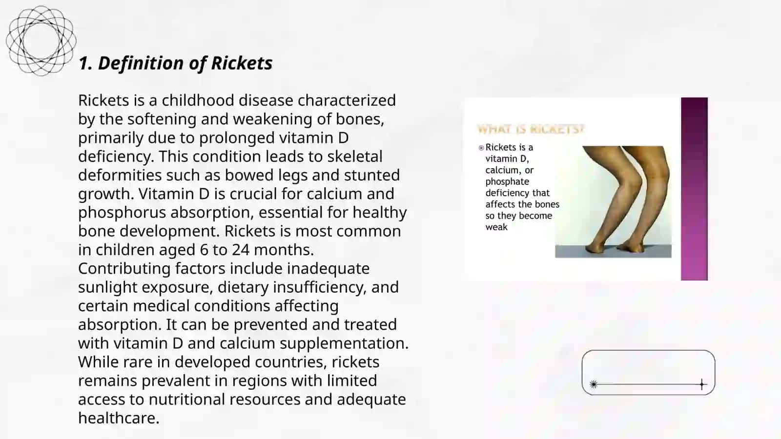 Rickets 3
