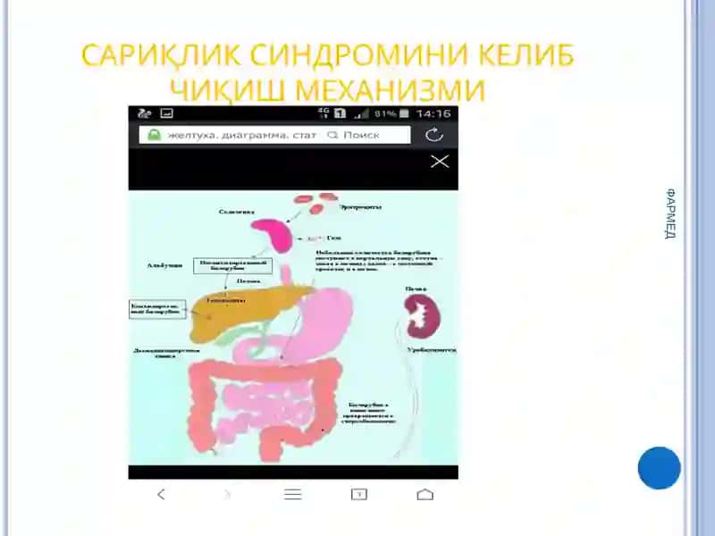 Сарикликда дифференциал диагноз. Умумиёт врачитактикаси 3