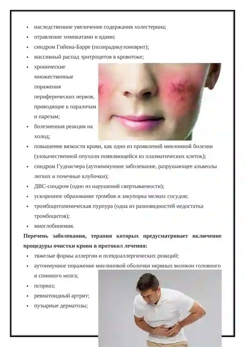 Плазмаферез 3