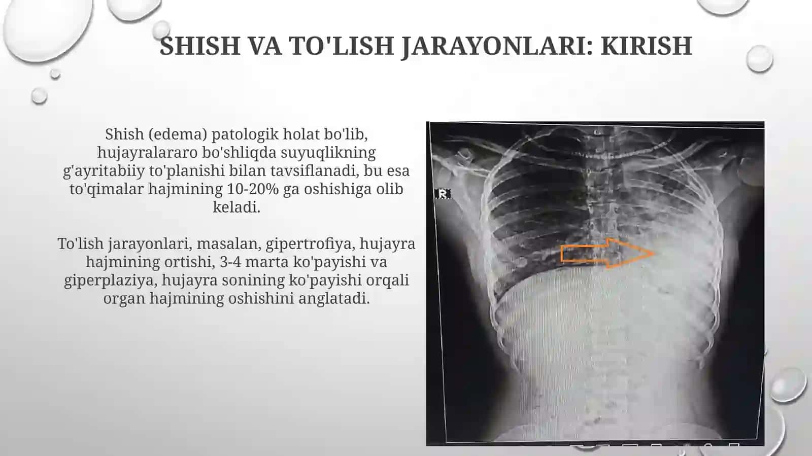 Shish va To'lish Jarayonlari: Patologik Anatomiya 3