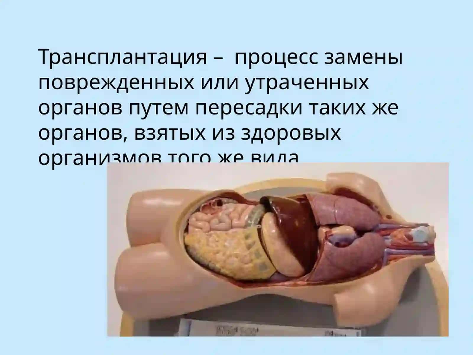 Трансплантация 3