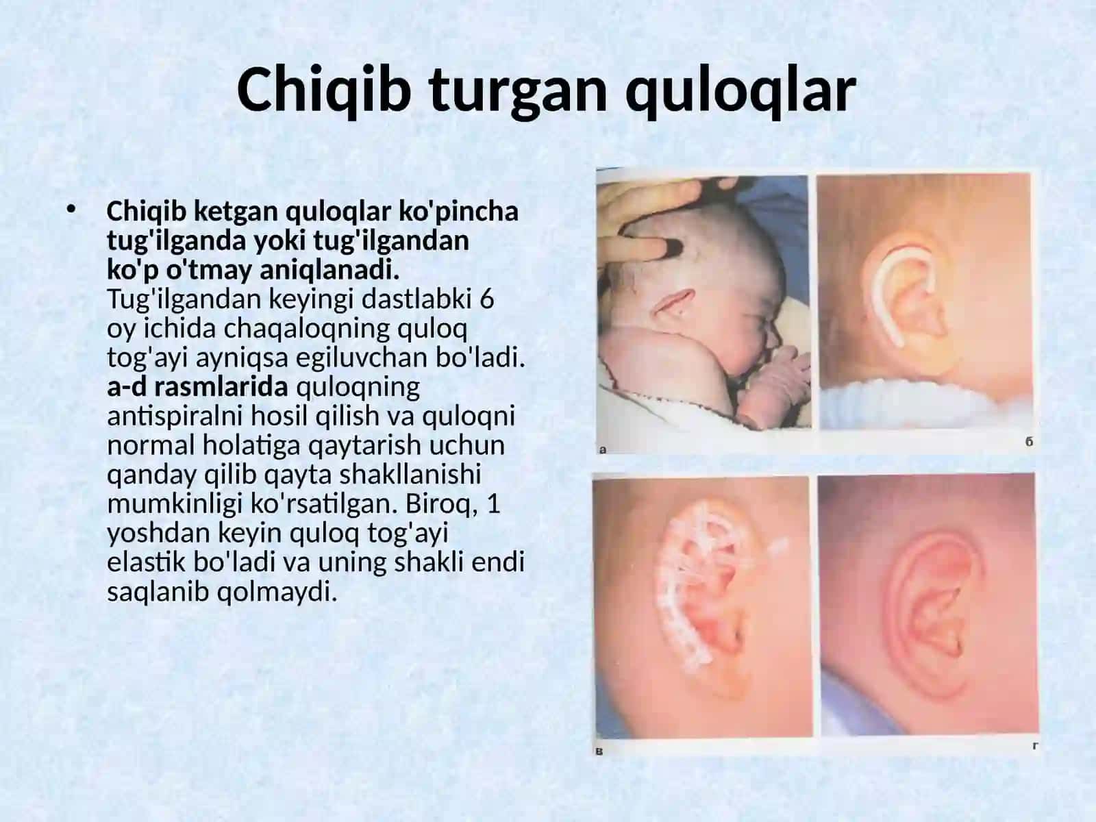 Tug'ma quloq anomaliyalari 3