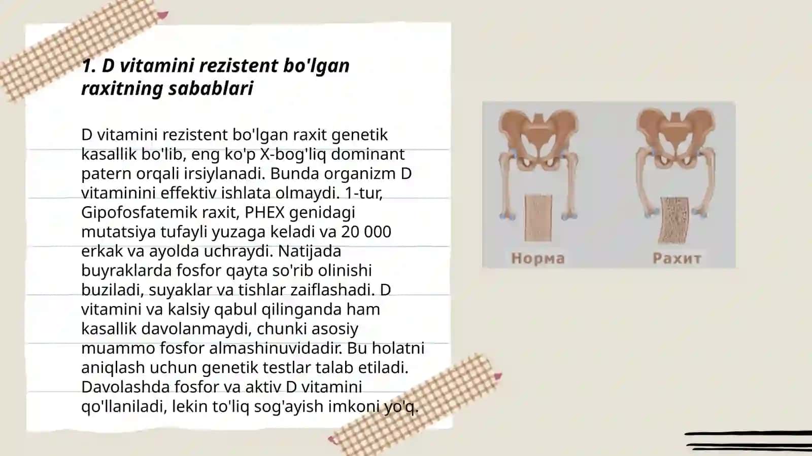 D vitamini rezistent bo'lgan raxit 3