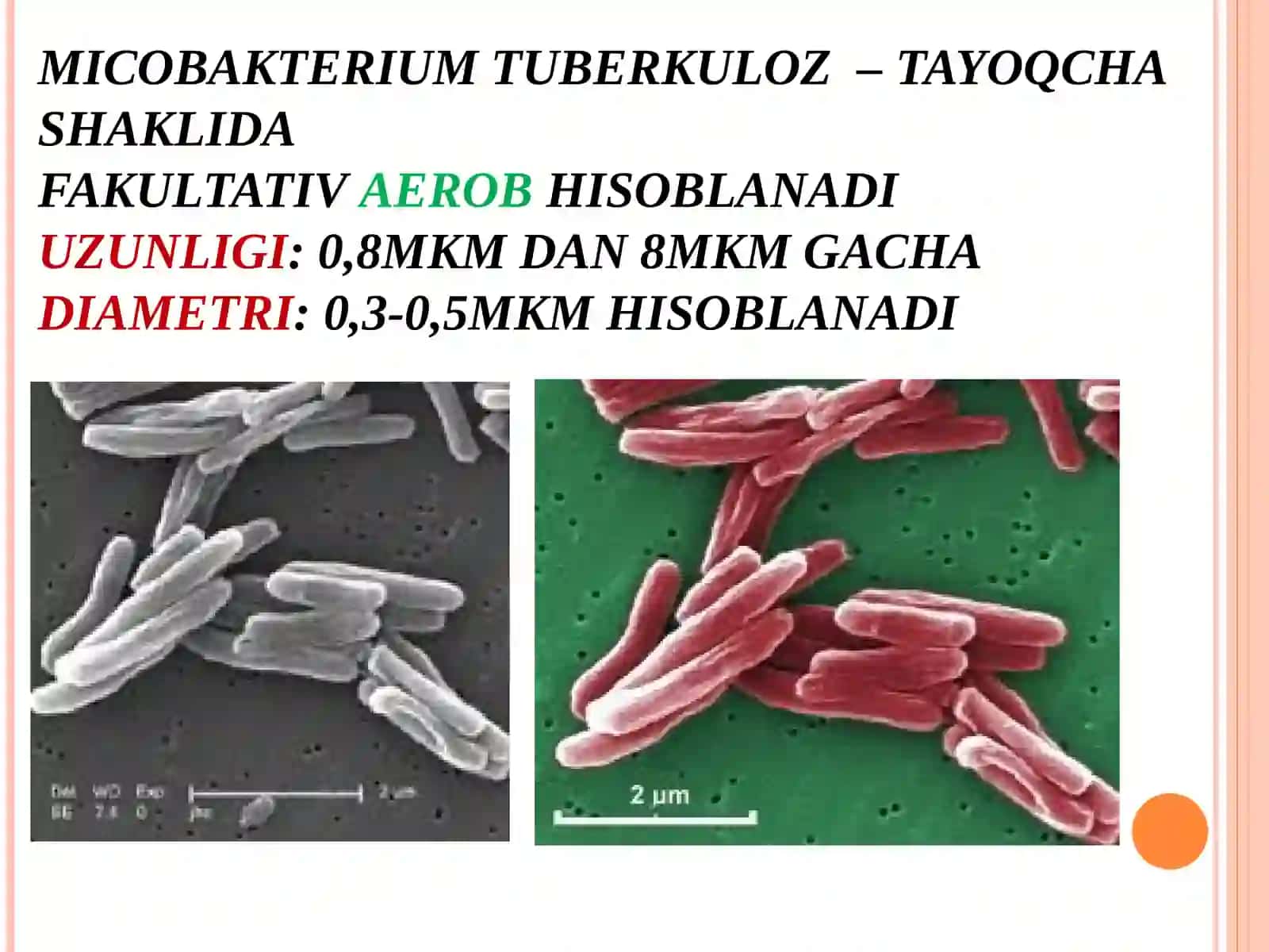 TUBERKULOZ (SIL) – “TUBERCULE” (BOʻRTMACHA) SOʻZIDAN OLINGAN HISOBLANADI 3