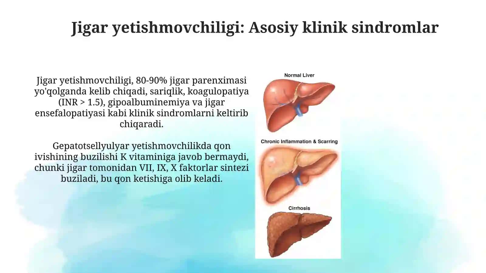 Jigar va ót yollari kasaliklari assosiykiliniksindromlari 3