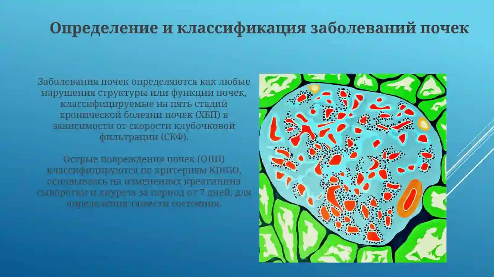 Презентация Заболевания почек. Аномалии развития. Гломерулопатии 3