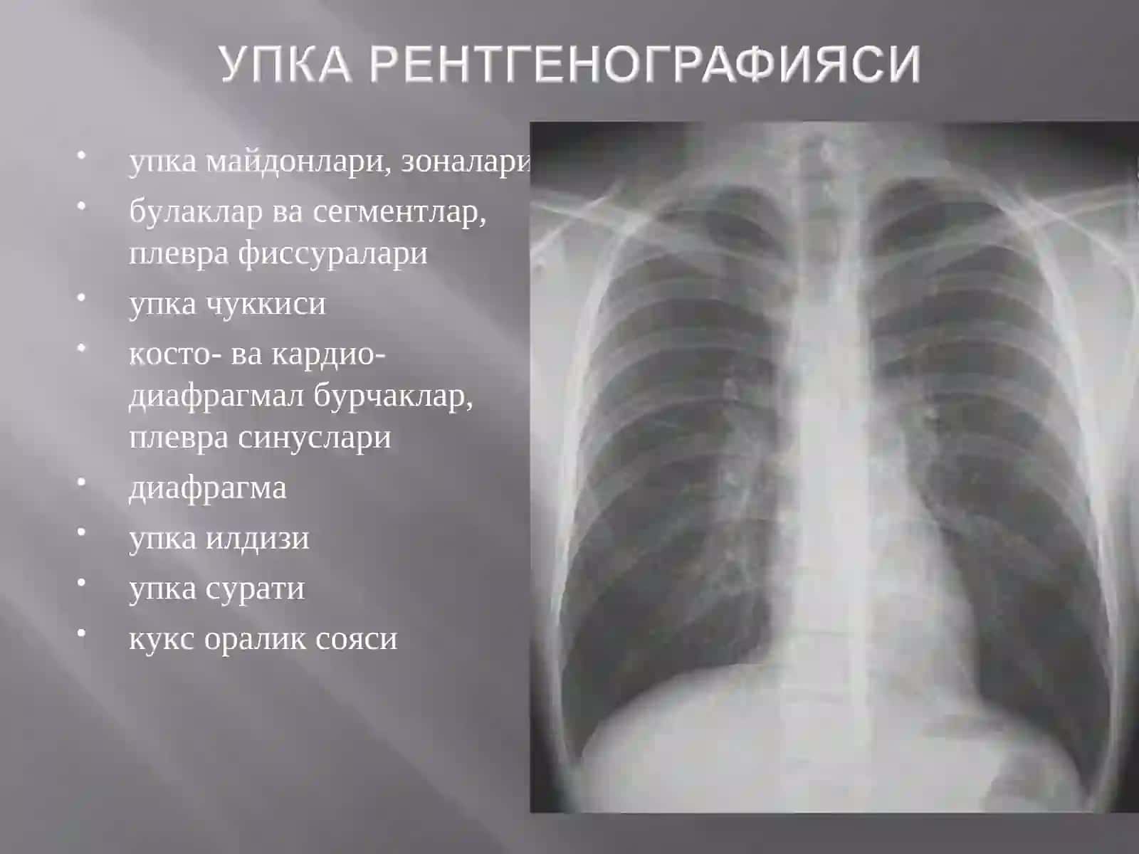Упка тукимасиёругбулади 3