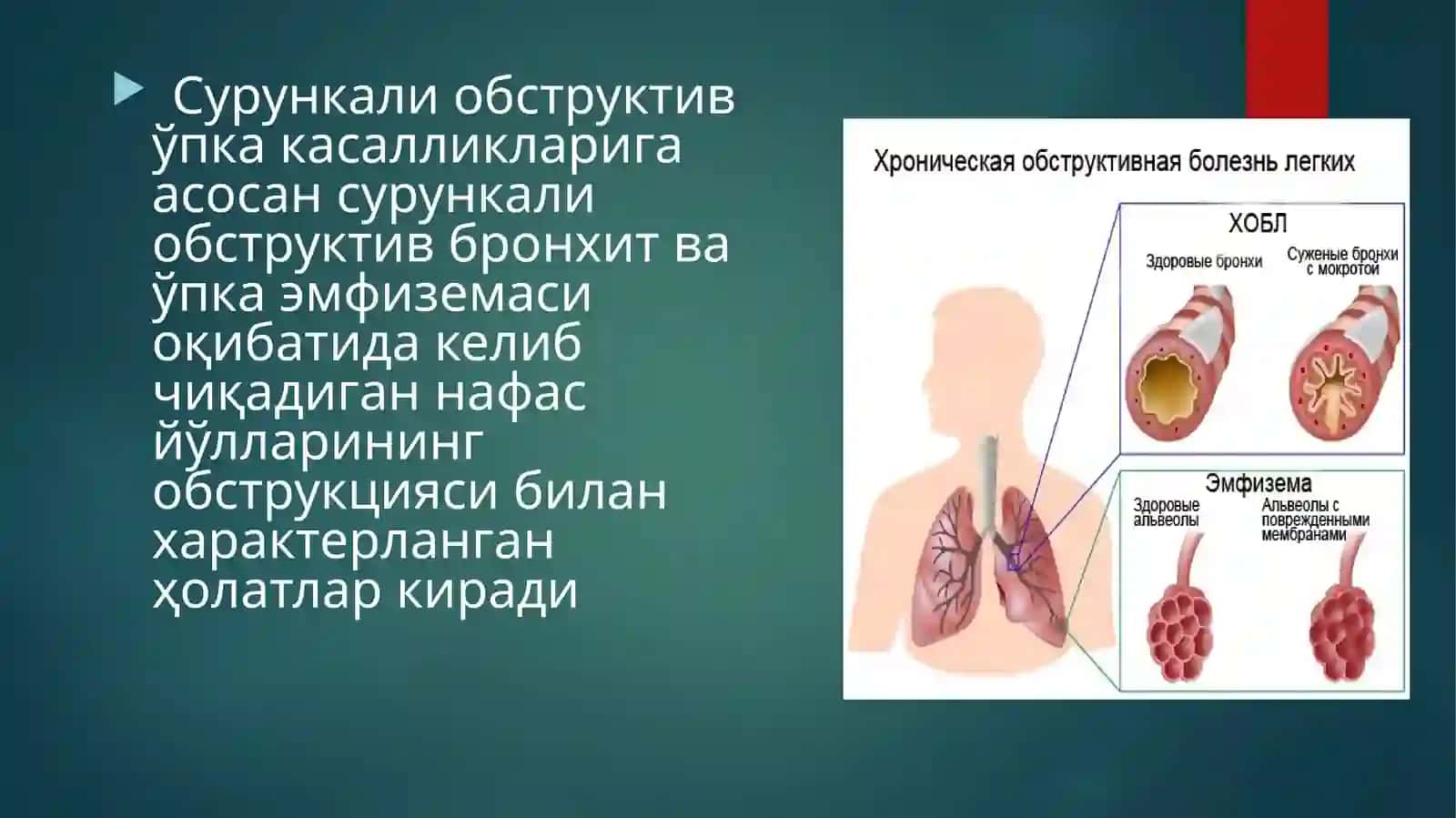 O'pkaning surunkali obstruktiv kasalliklari 3