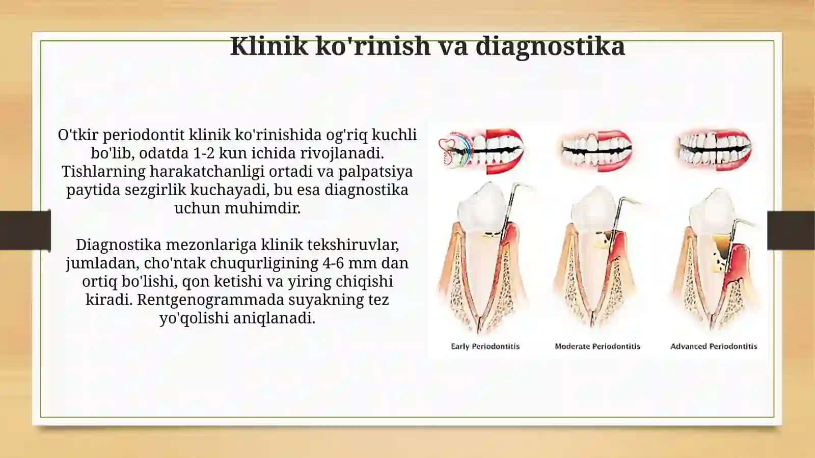 O‘tkir periodontitlarning o‘ziga xos klinik kechishi, qiyosiytashxisi 3