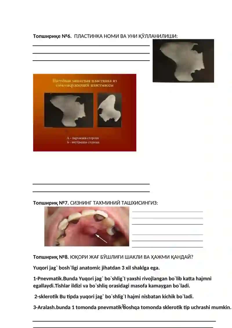 2 – ОДОНТОГЕНГАЙМОРИТ. ЮҚОРИ ЖАҒ БЎШЛИҒИ ТУБИ ПЕРФОРАЦИЯСИ. ДИАГНОСТИКА ВА ДАВОЛАШ ПРИНЦИПЛАРИ АЛГОРИТМЛАРИ 3