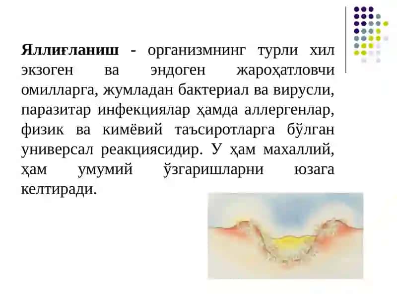 Стероид ва ностероид  яллиғланишга қарши дори воситалари 3