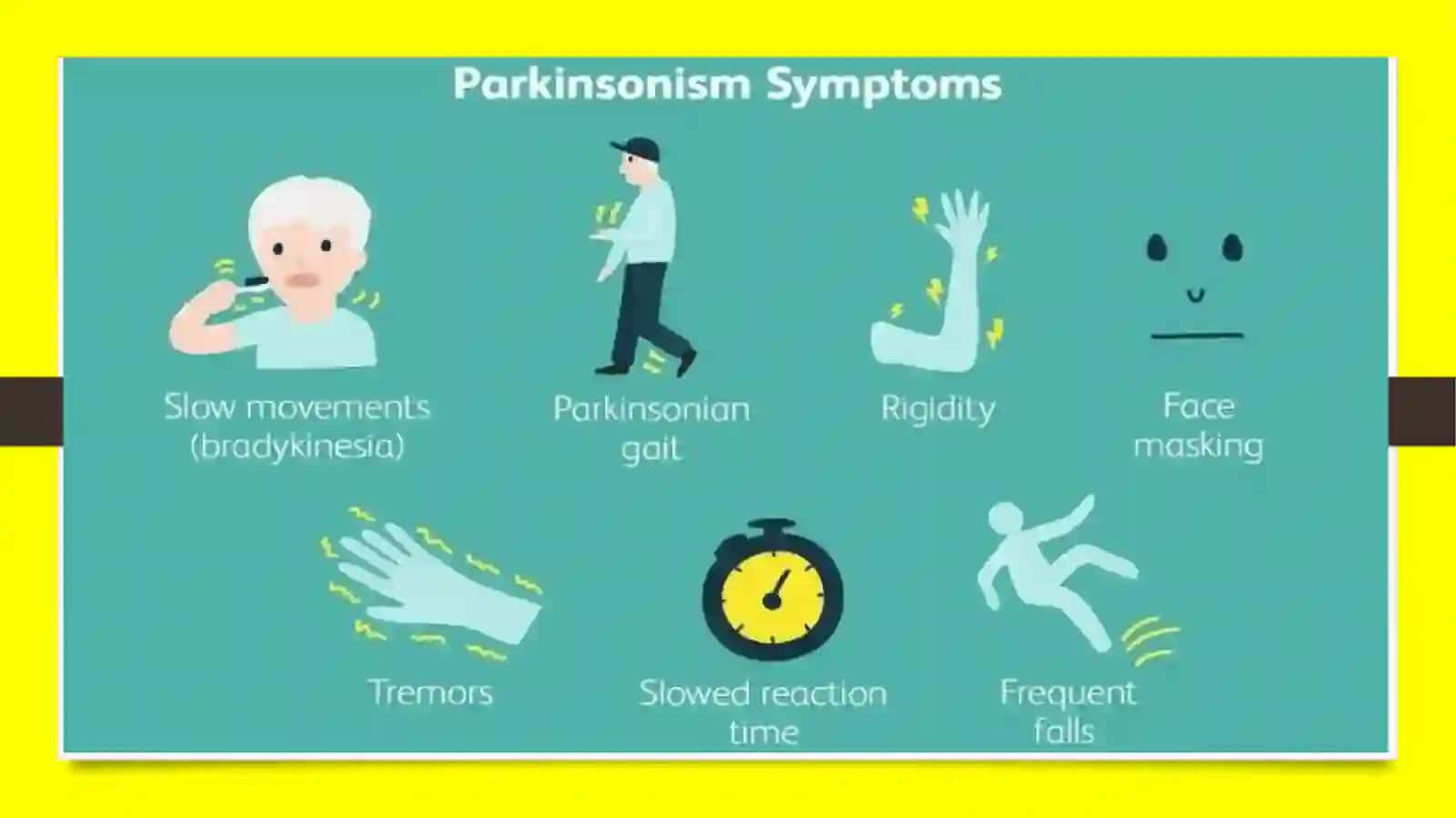 Parkinson kasalligi 3