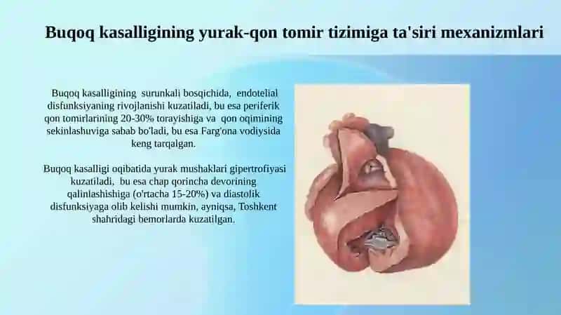 Buqoq Kasalligida Yurak-Qon Tomir Tizimidagi Oʻzgarishlar 3