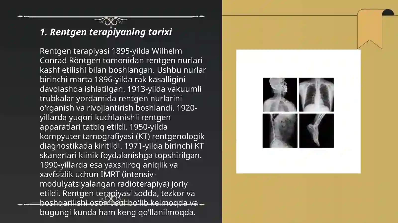 Rentgen terapiya 3