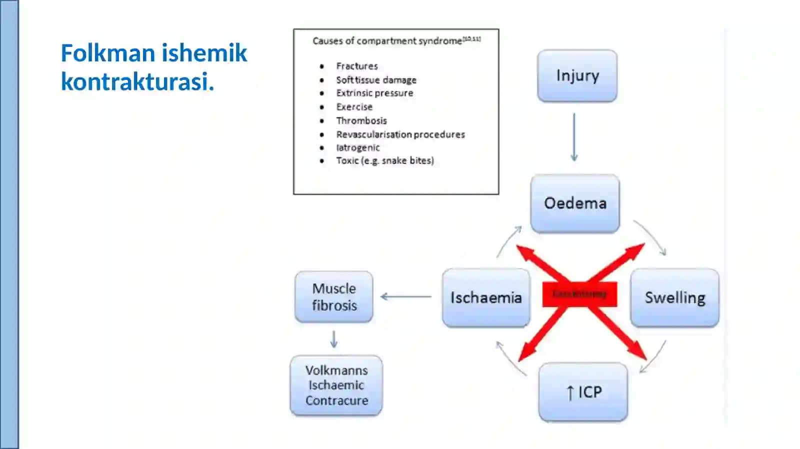 Folkman ishemik kontrakturasi. 3