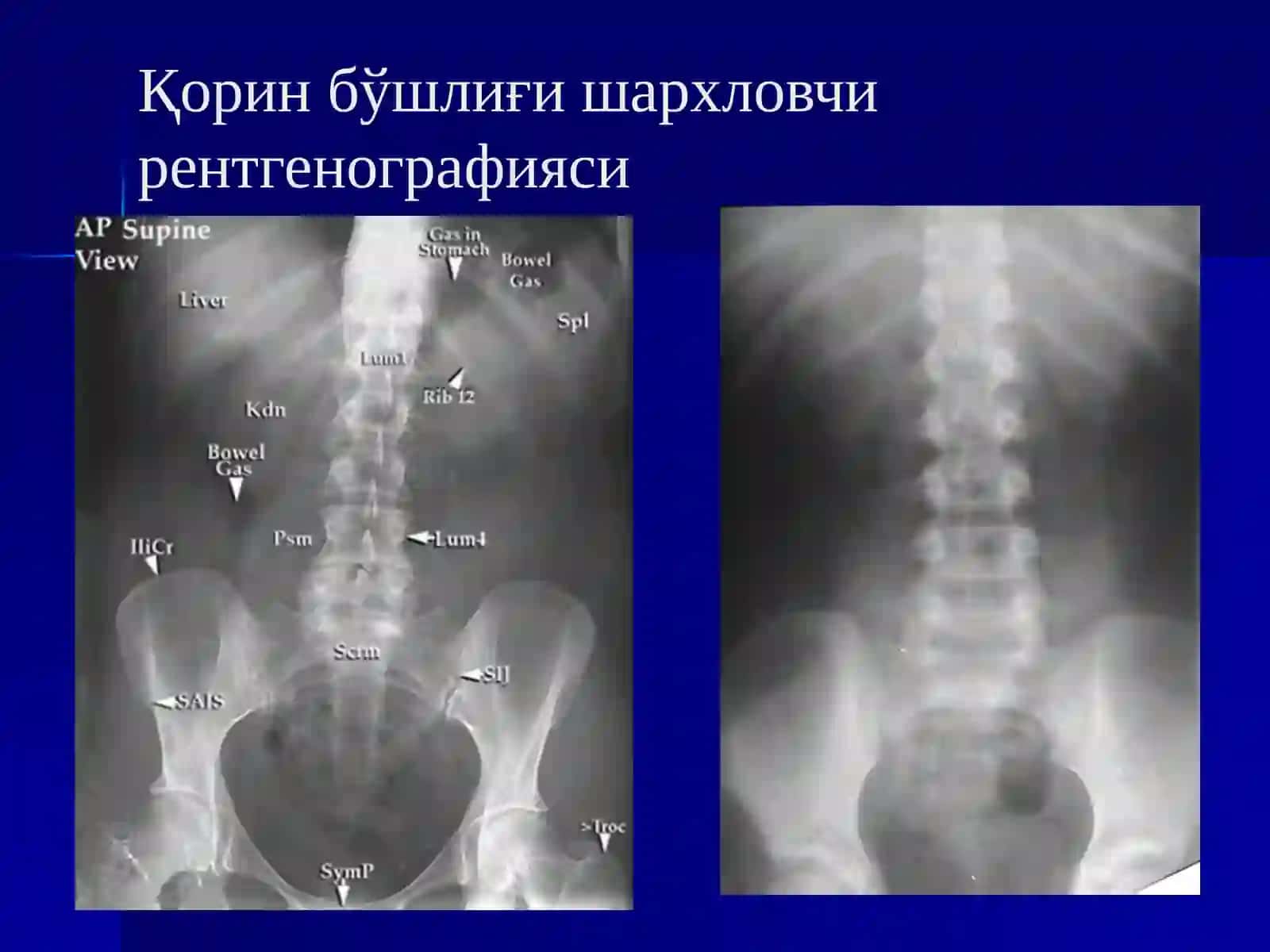 Ошқозон ичак тизими касалликларида нур текшириш усуллари 3