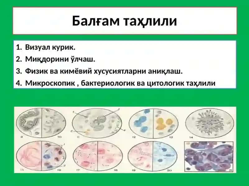 Балғам Таҳлили 3