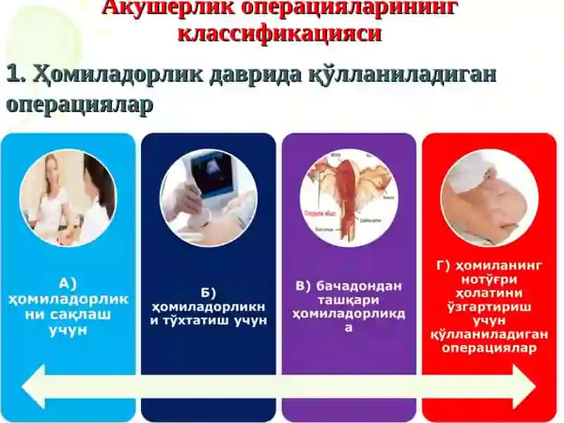 Tug’ruqni amalga oshiruvchi operastiyalar kesar kesish, akusherlik qisqichlari, vakuum ekstrakstiya. 3