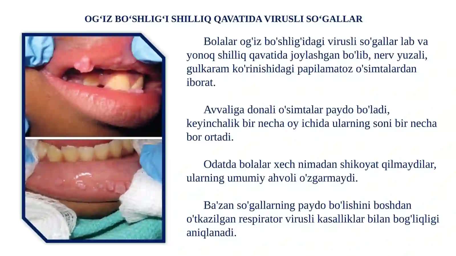 OG‘IZ BO‘SHLIG‘I SHILLIQ QAVATIDA VIRUSLI SO‘GALLAR 3
