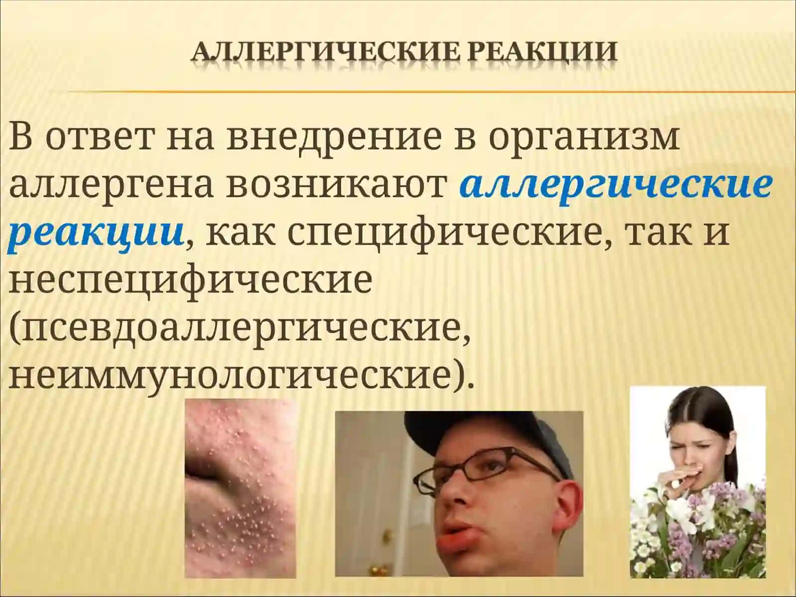 Аллергия 3