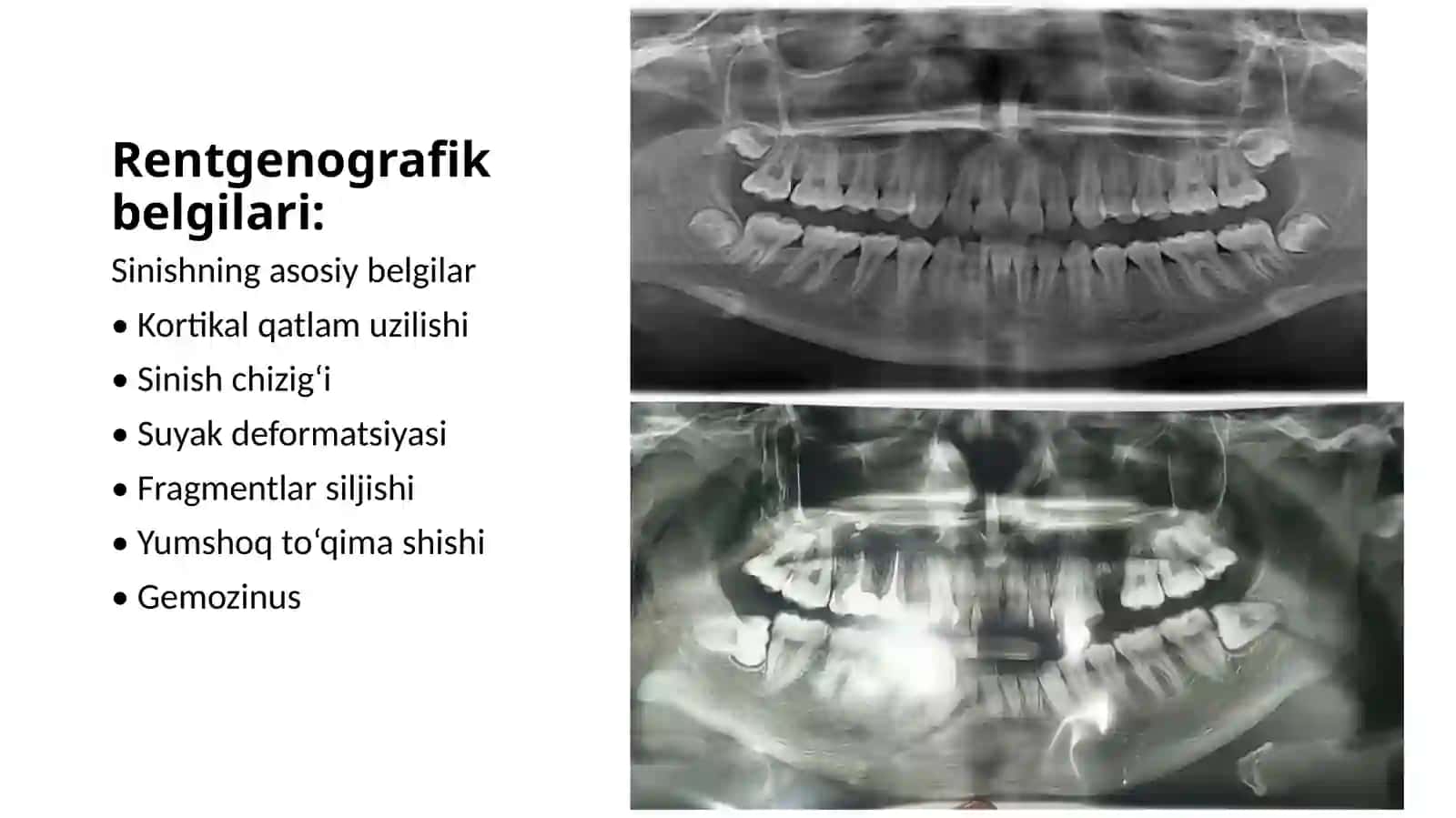 Fragmentlarsiljishinikorsatadi 3